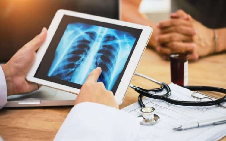 infecção pulmonar, doença, dano tecidual, resposta imunológica, tecidos pulmonares, sobrevida, imunidade, inalação, resposta imune, infecção, saúde pública, diagnóstico, tratamento, dor de cabeça, dor de barriga, doença grave