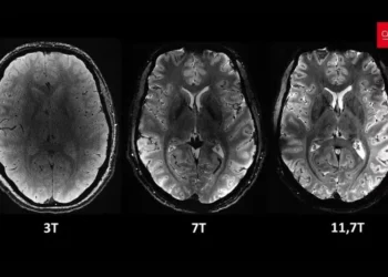 cérebro humano, órgão cerebral