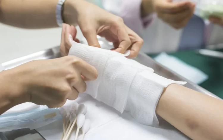 acidentes com queimaduras, hospitalizações por queimaduras, internamento por queimaduras;